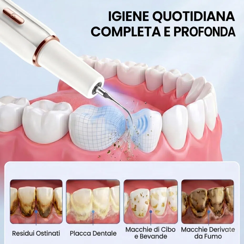 Kit Pulizia Denti Tartaro，Spazzolino Elettrico Ultrasuoni Intelligente con 5 Modalità Per Rimozione Placca e Macchie con 5 Testine Intercambiabili e Luci LED per Pulizia Tartaro Uso Quotidiano a Casa